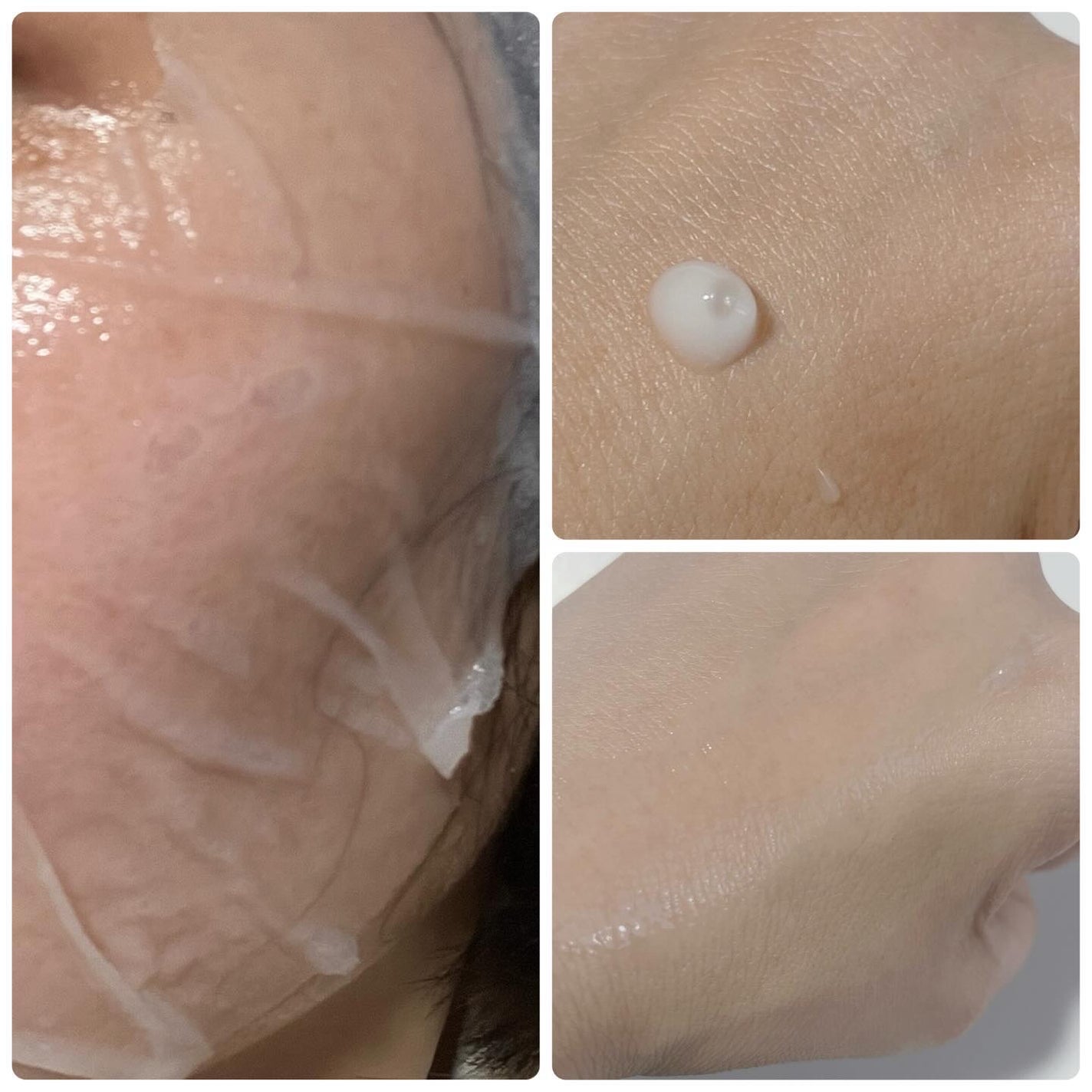 リードルショット100/VT/美容液を使ったクチコミ(3枚目)