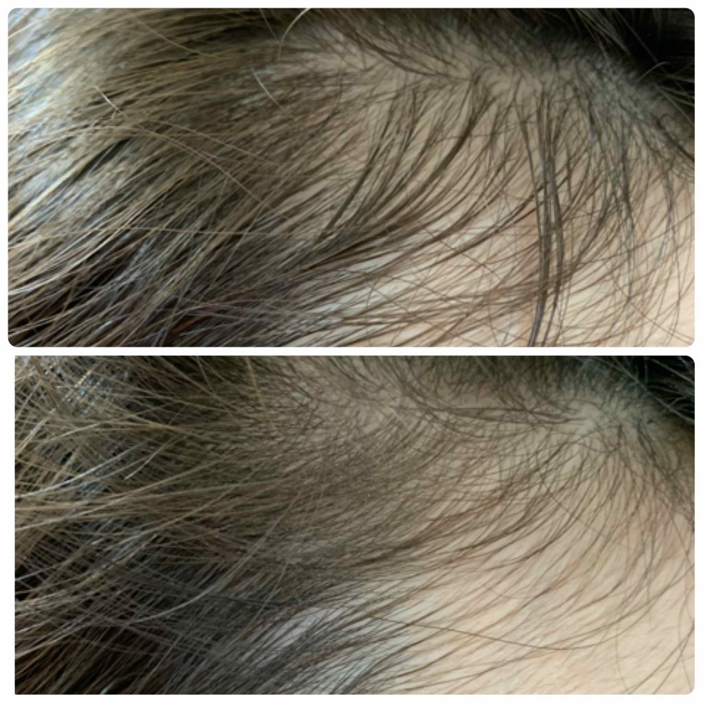 ドライ シャンプー/スティーブンノル ニューヨーク/ドライシャンプーを使ったクチコミ（2枚目）