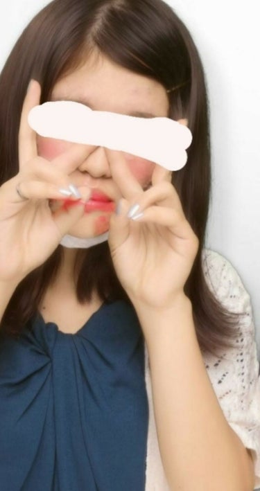 気まぐれちゃん on LIPS 「⚠2枚目から閲覧注意⚠前回の肌荒れ投稿から1ヶ月くらい？経ちま..」（2枚目）