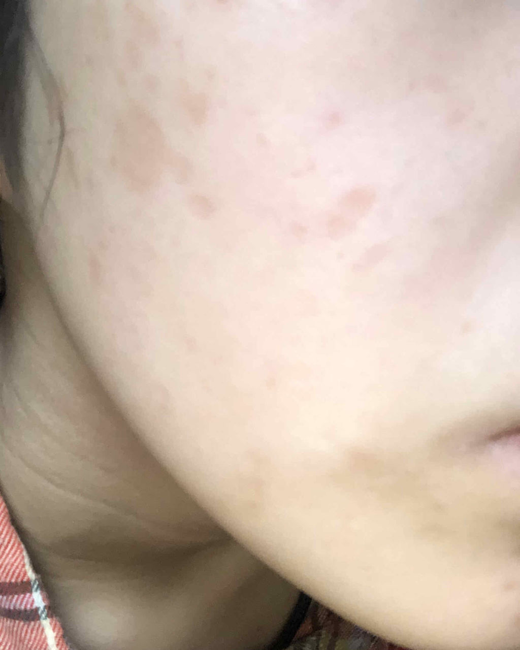 チョコラBBプラス (医薬品)/チョコラBB/その他を使ったクチコミ（3枚目）