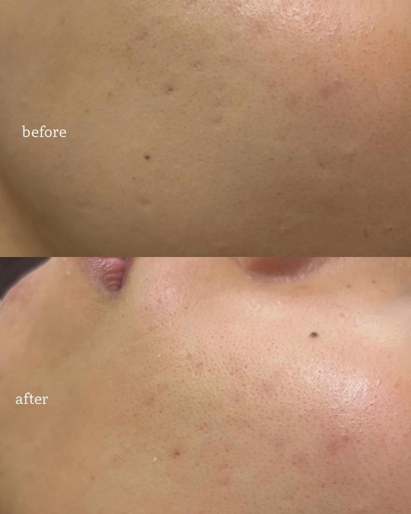 敏感肌用化粧水 高保湿/無印良品/化粧水を使ったクチコミ(5枚目)