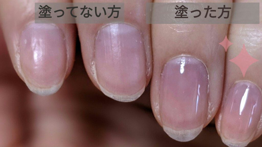 エテュセ クイックケアコート/ettusais/ネイルオイル・トリートメントを使ったクチコミ(2枚目)