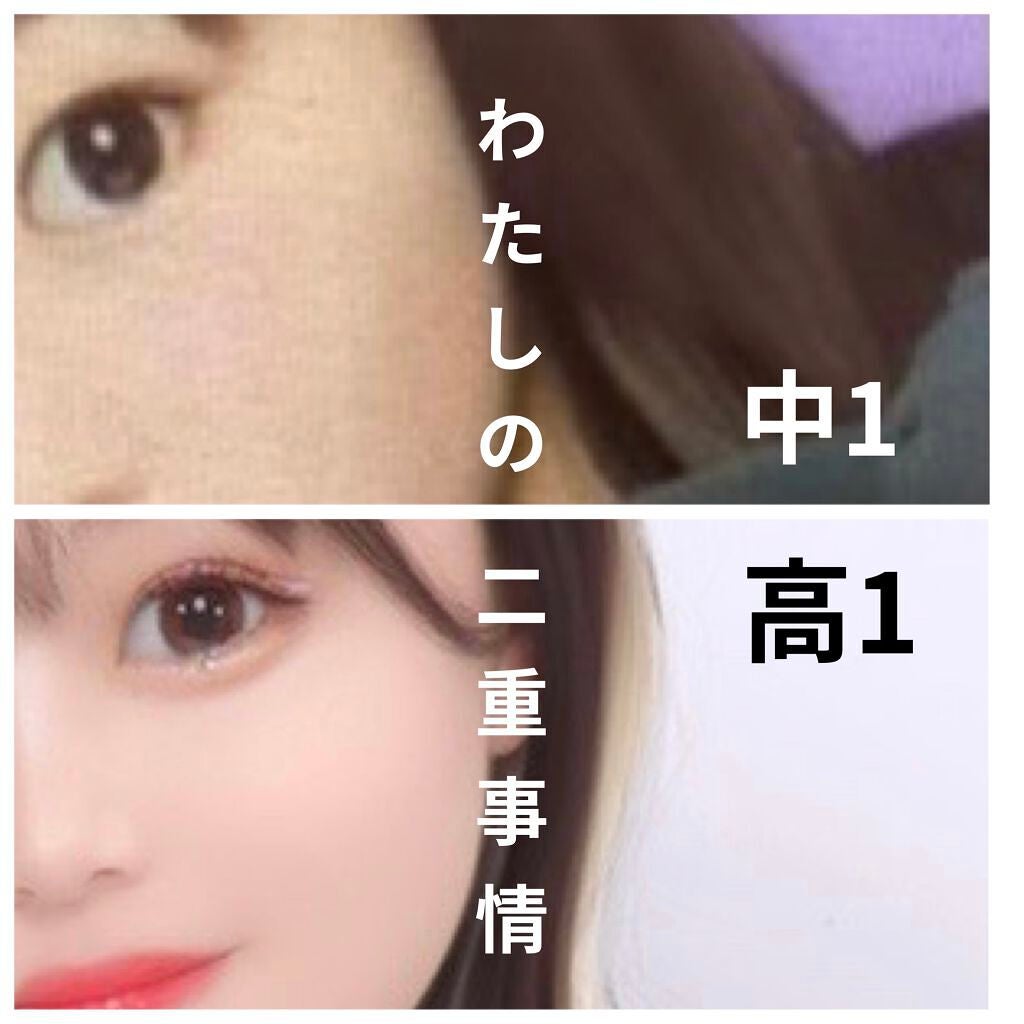 アイビューティー フィクサー WP/アストレア ヴィルゴ/二重まぶた用アイテムを使ったクチコミ(1枚目)