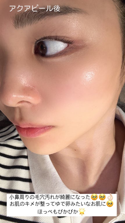 ãããð몚몚칎 on LIPS ãæž¡éåå¿è
ð°æ¥æ¬äººã«ããããçŸå®¹ã¯ãªããã¯ãã§ã³ãã OKæŽåœ¢å€..ãïŒ5æç®ïŒ