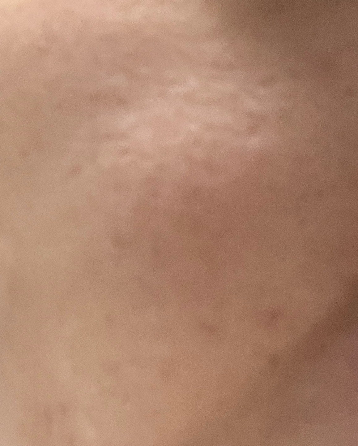 ユース ラディアンス ビタチノール セラム/primera/美容液を使ったクチコミ(5枚目)