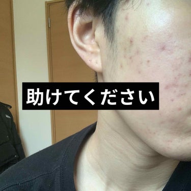 敏感肌用薬用美白美容液/無印良品/美容液を使ったクチコミ（1枚目）