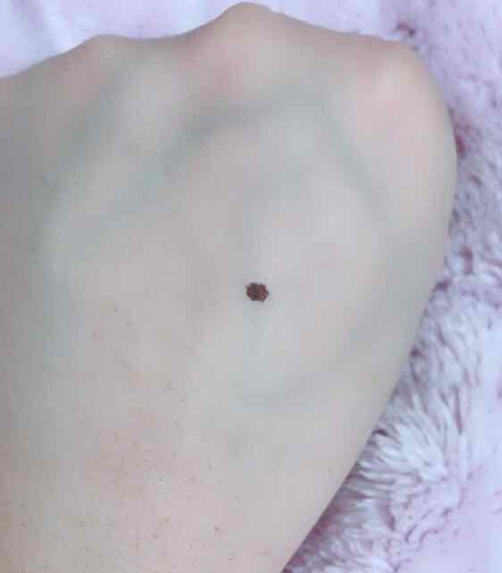 ラディアント タッチ/YVES SAINT LAURENT BEAUTE/リキッドコンシーラーを使ったクチコミ(2枚目)