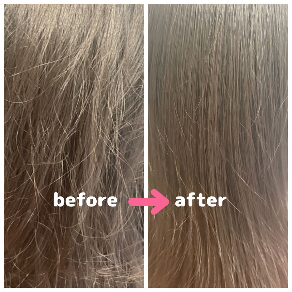 リファイオンケアブラシ/ReFa/スカルプブラシを使ったクチコミ（2枚目）