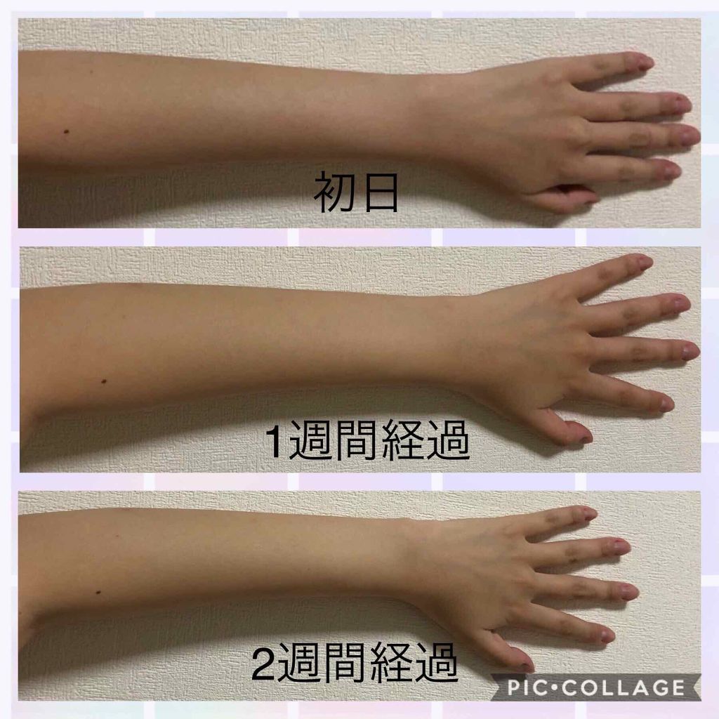 エバレッシュホワイトEXⅡ(医薬品)/matsukiyo/その他を使ったクチコミ（2枚目）