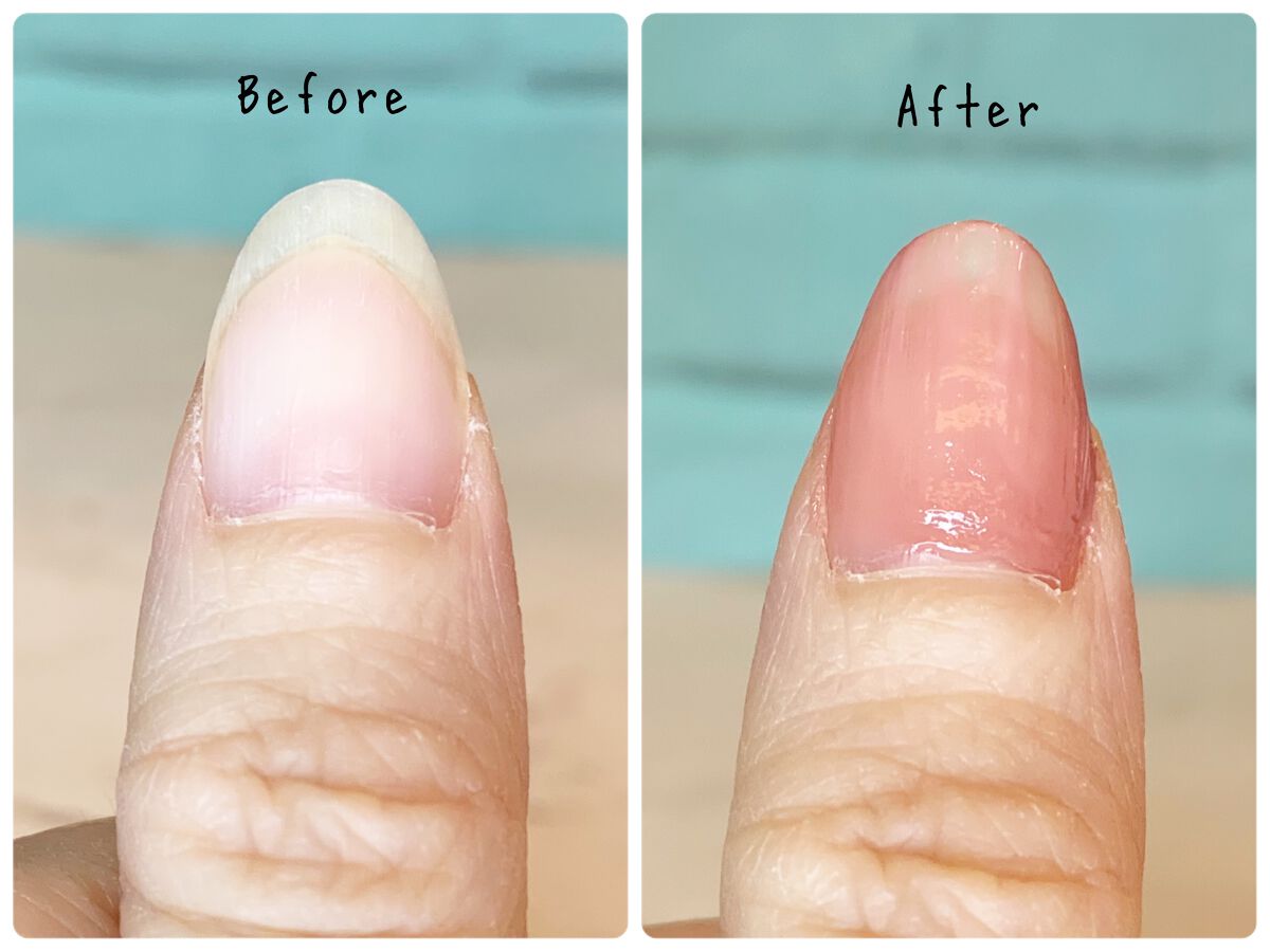 1Day密封ネイルケアパック/DAILY NAILLY/ネイルオイル・トリートメントを使ったクチコミ（3枚目）