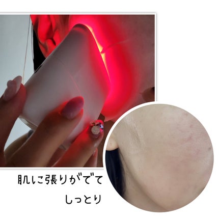 スキンライトセラピーII/Makeon/美顔器・マッサージを使ったクチコミ(3枚目)