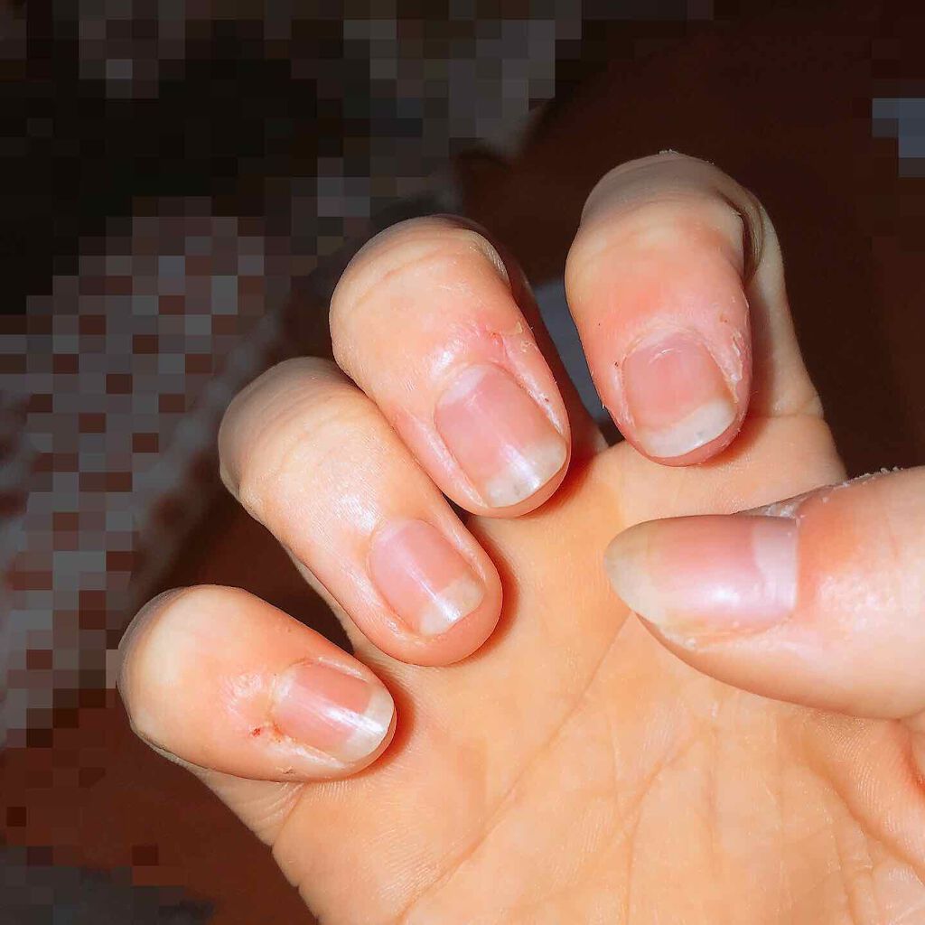 カラフルネイルズ TO(トリートメントオイル)/キャンメイク/ネイルオイル・トリートメントを使ったクチコミ（2枚目）