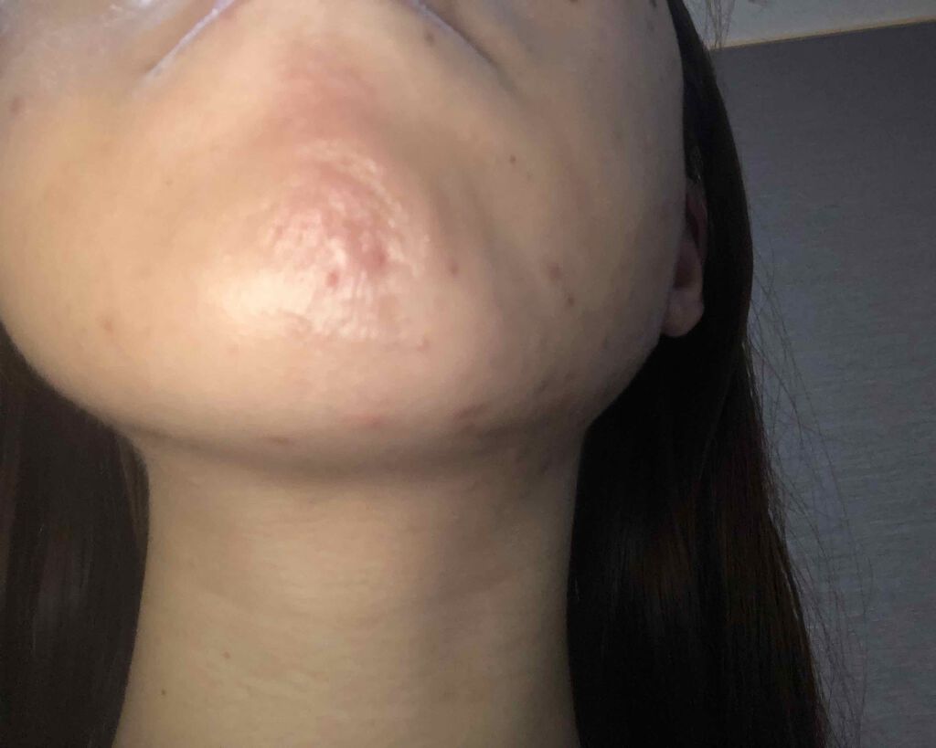 パワーマスク/ラッシュ/洗い流すパック・マスクを使ったクチコミ（3枚目）