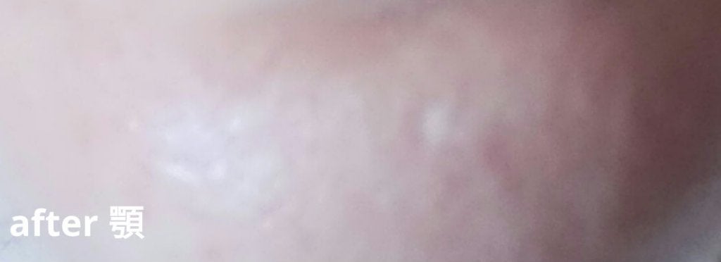 ミラミックス/ZO Skin Health/フェイスクリームを使ったクチコミ(5枚目)