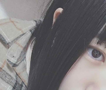 のびーるアイテープ(絆創膏タイプ、レギュラー)/DAISO/二重まぶた用アイテムを使ったクチコミ(1枚目)