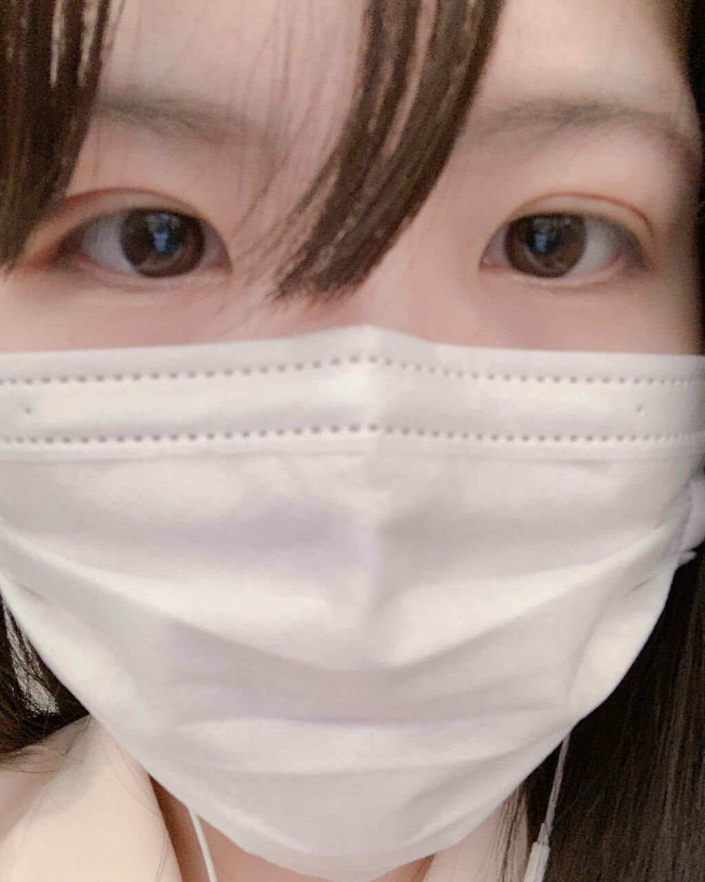 二重整形/その他を使ったクチコミ（1枚目）