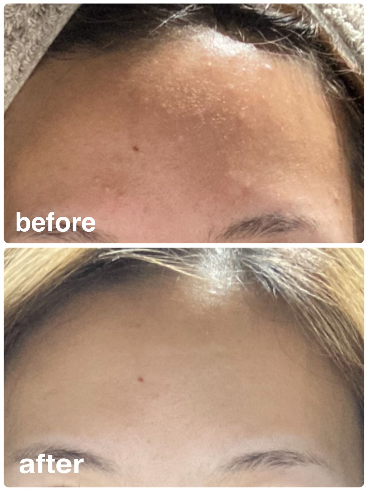 薬用エマルジョン/IHADA/乳液を使ったクチコミ（2枚目）