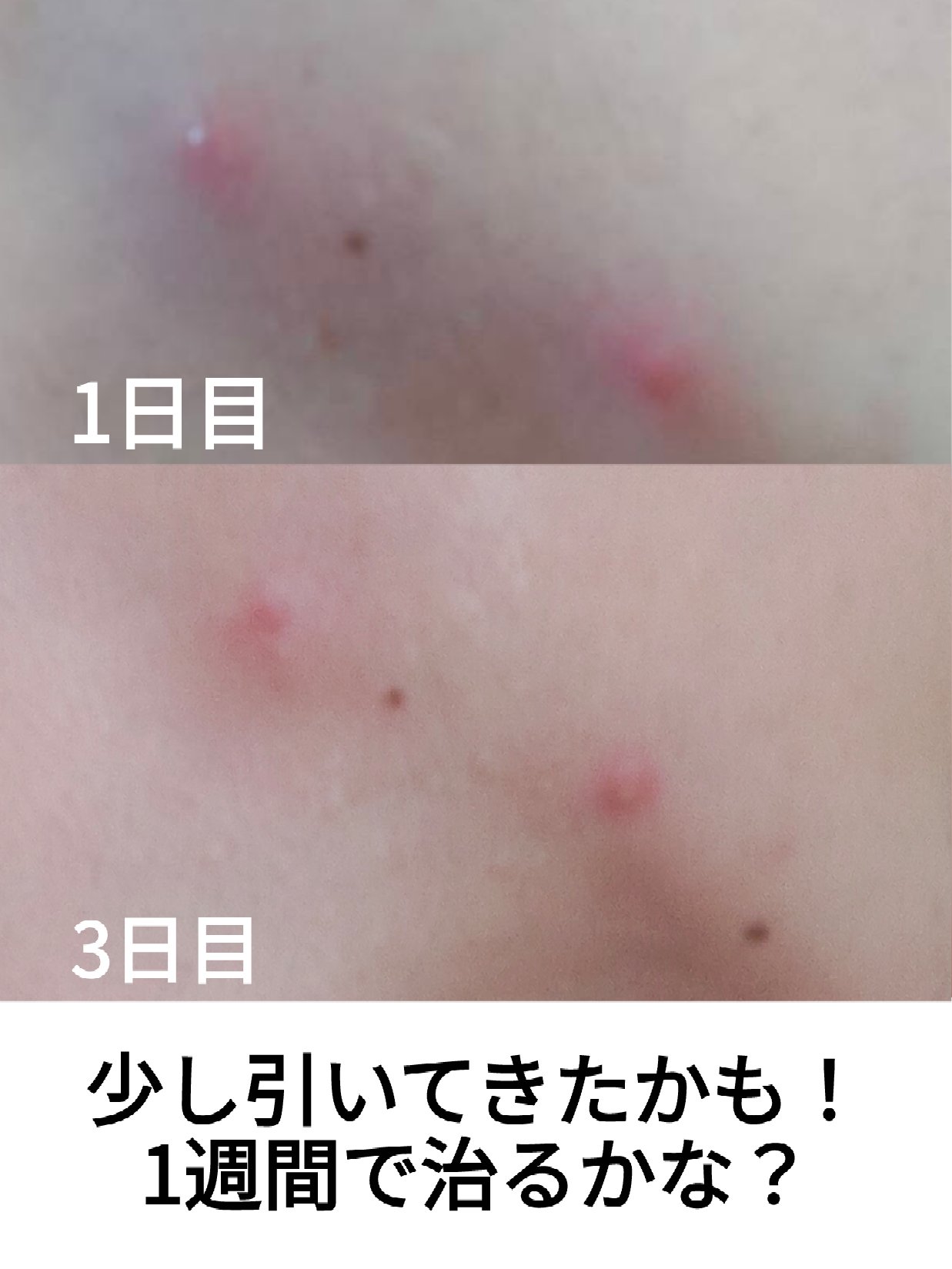 メンズビオレ ザフェイス　毛穴汚れクリア/メンズビオレ/泡洗顔を使ったクチコミ（2枚目）