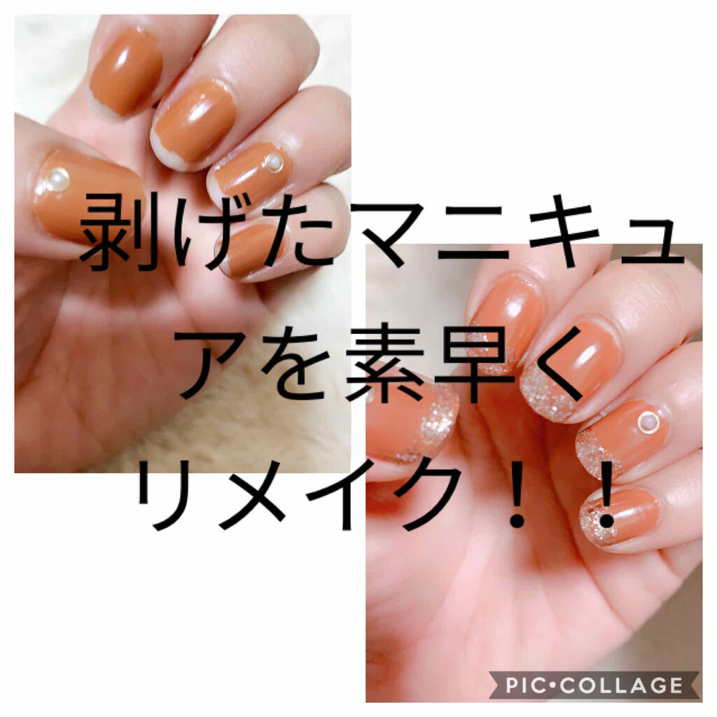 ネイルホリック ネイルホリックの口コミ 剥げたマニキュアを素早く直す 私 By じじちゃん 混合肌 30代後半 Lips