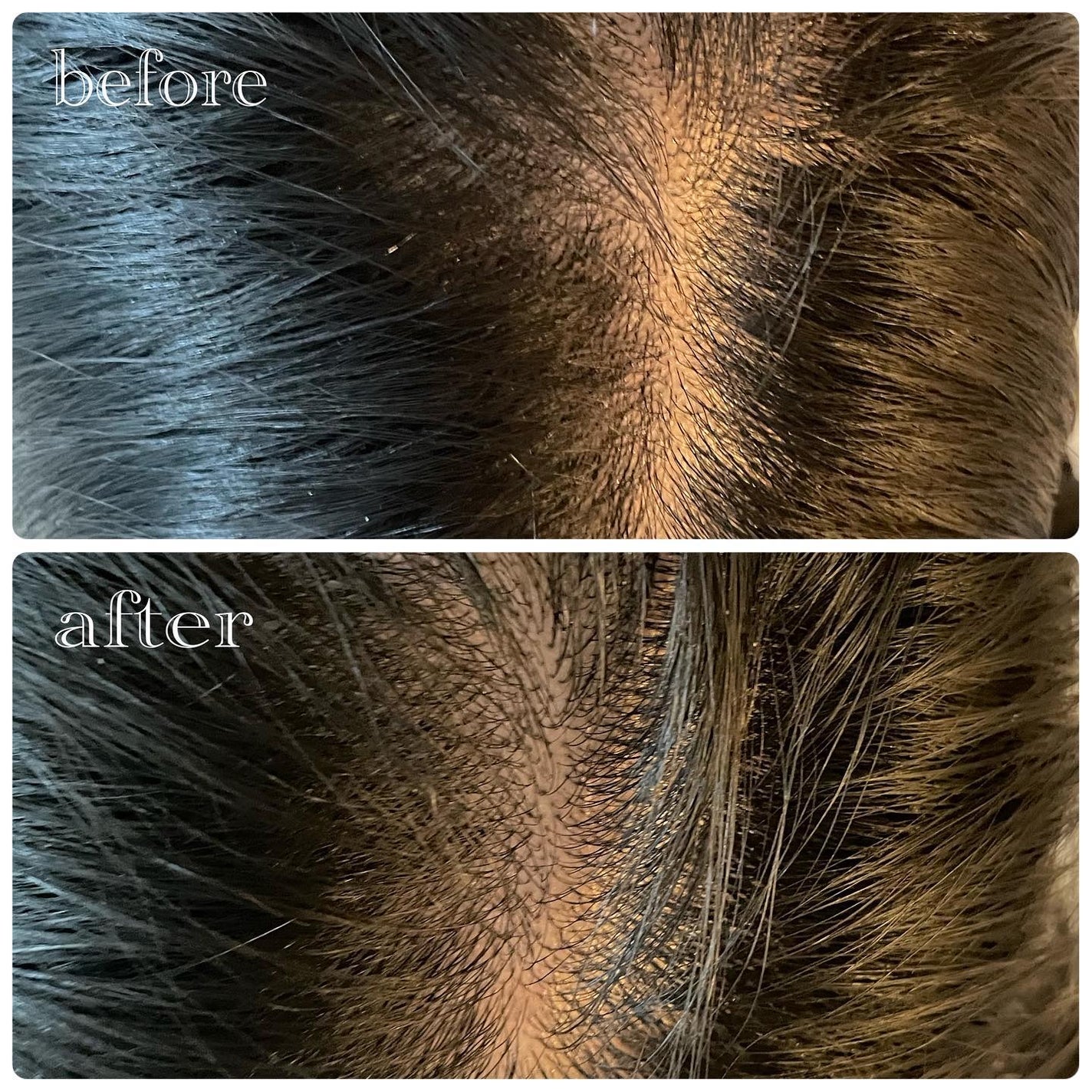 薬用 RJ地肌ケア エッセンス /アピセラピーコスメティクス/頭皮ローションを使ったクチコミ(8枚目)