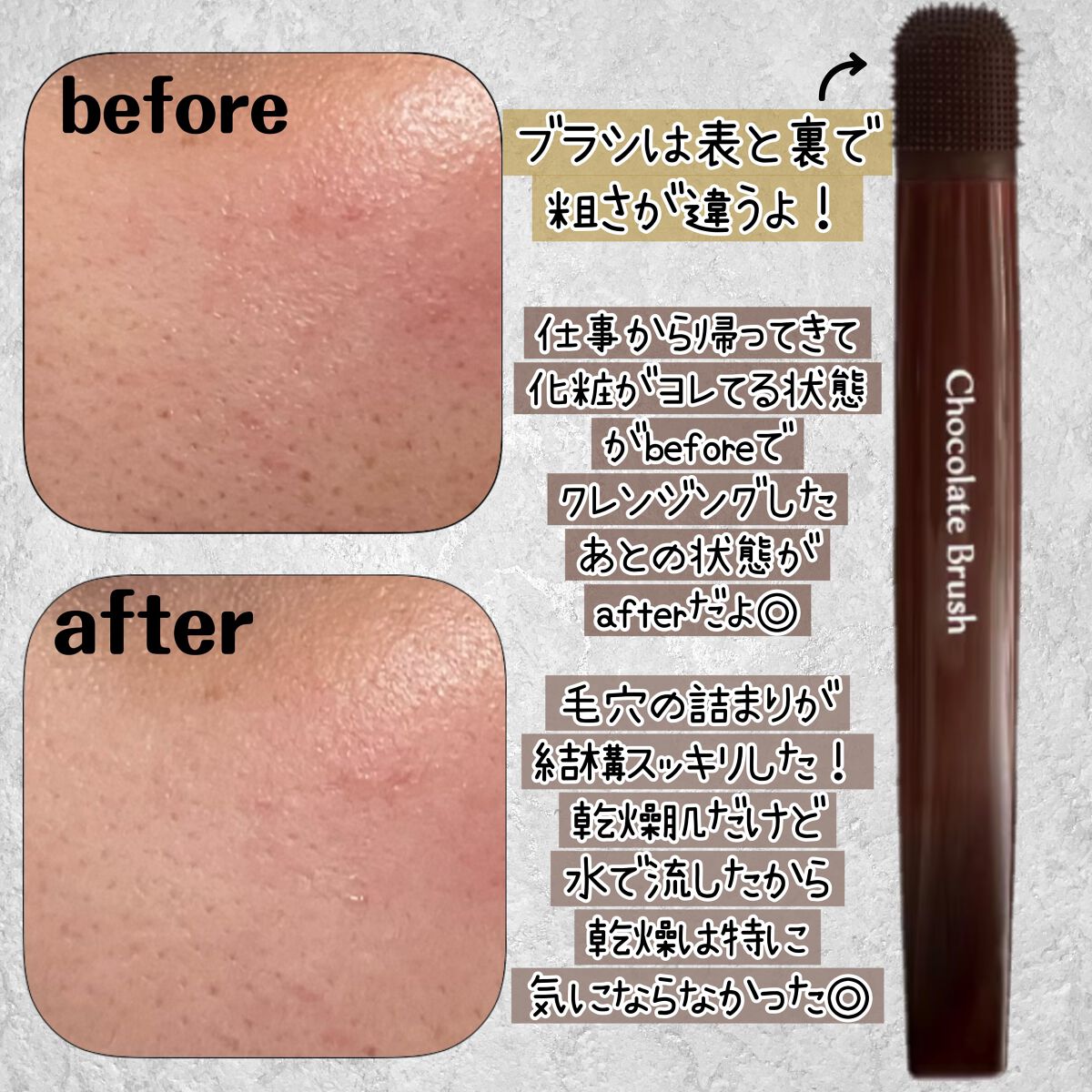 チョコブラ スペシャル毛穴ケアセット/Chocobra/スキンケアキットを使ったクチコミ（2枚目）