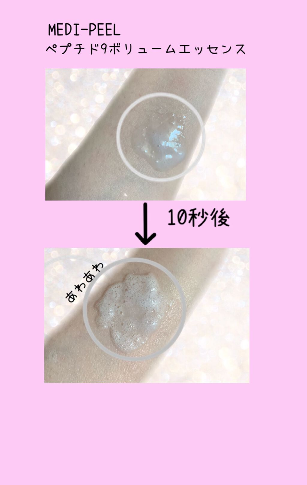 PEPTIDE 9 VOLUME ESSENCE /MEDIPEEL/美容液を使ったクチコミ(2枚目)