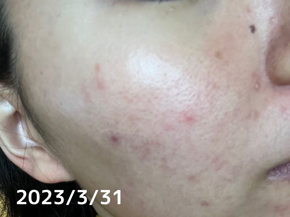 マジックカタツムリクリーム/ブラン/フェイスクリームを使ったクチコミ(3枚目)