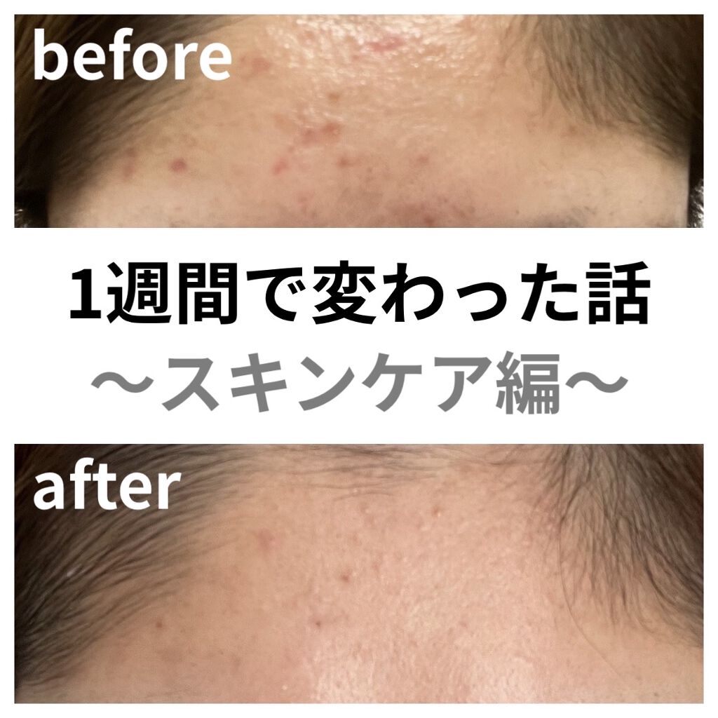 クリアトライアルセット L（さっぱり）/オルビス/トライアルキットを使ったクチコミ（1枚目）