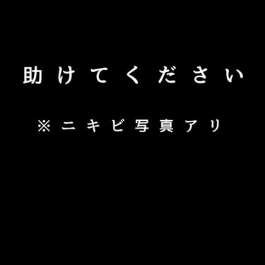 カウブランド 赤箱 (しっとり)のクチコミ「助けてください………！

ニキビ、肌荒れ、ボコボコ毛穴、黒ずみ…………！人生で一番肌荒れがひど.....」（1枚目）