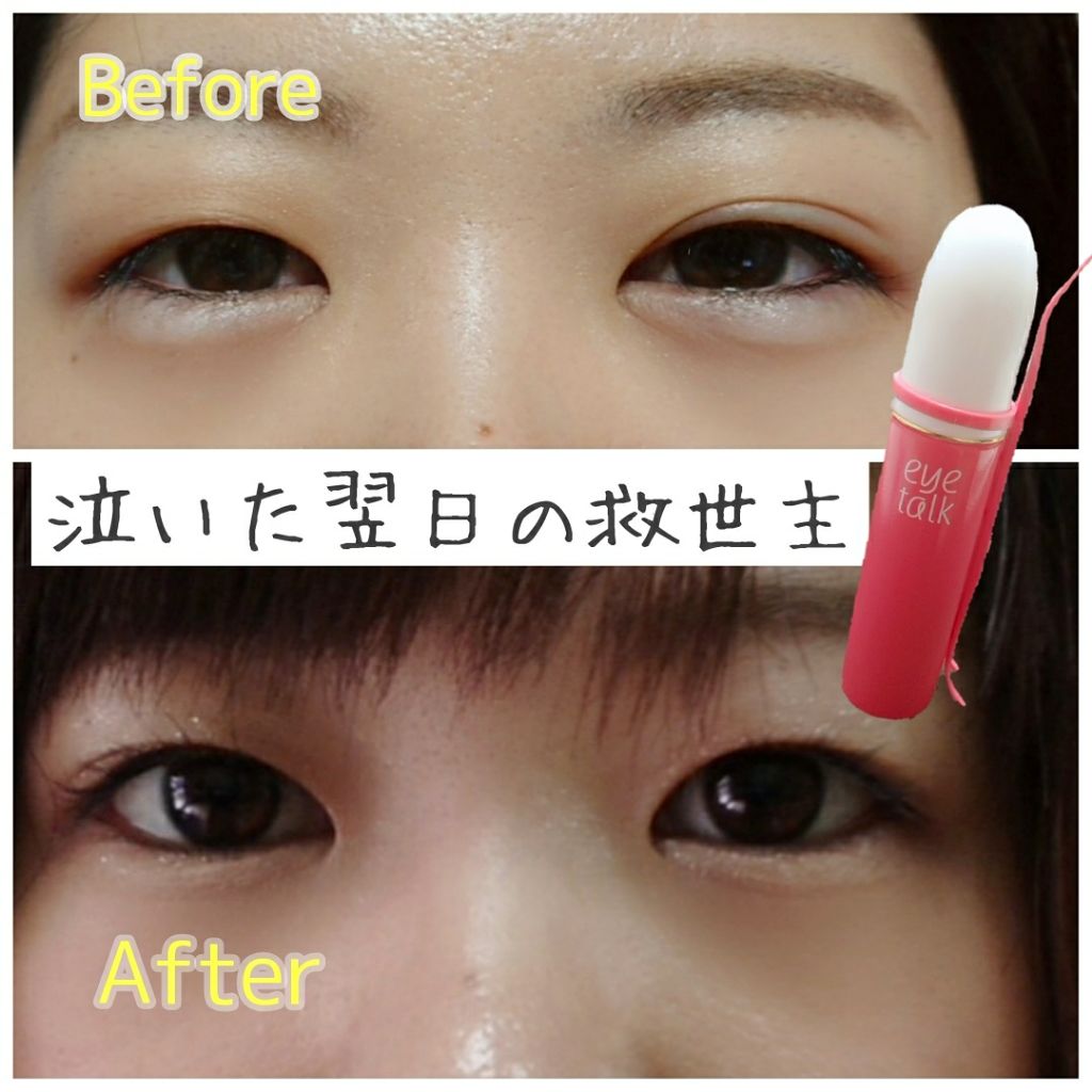 アイトーク/アイトーク/二重まぶた用アイテムを使ったクチコミ(1枚目)