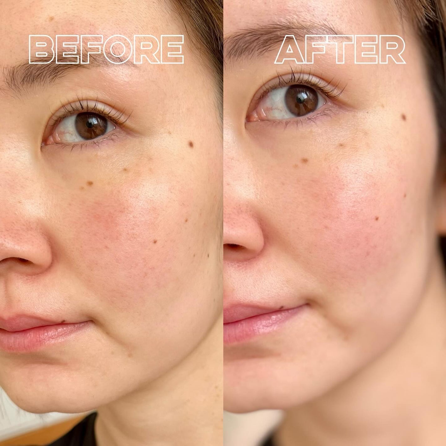 サンシェルター マルチ プロテクション エクストリーム コンフォート/DECORTÉ/日焼け止めジェルを使ったクチコミ(4枚目)