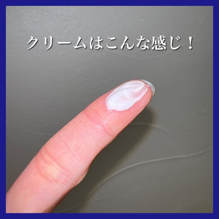 ペアアクネクリームW(医薬品)/ペア/その他を使ったクチコミ(2枚目)