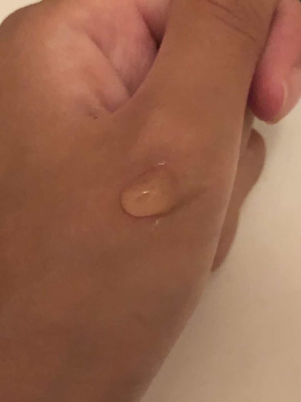 エーシーコンフロント スポッツ エッセンス/ハウス オブ ローゼ/美容液を使ったクチコミ（2枚目）