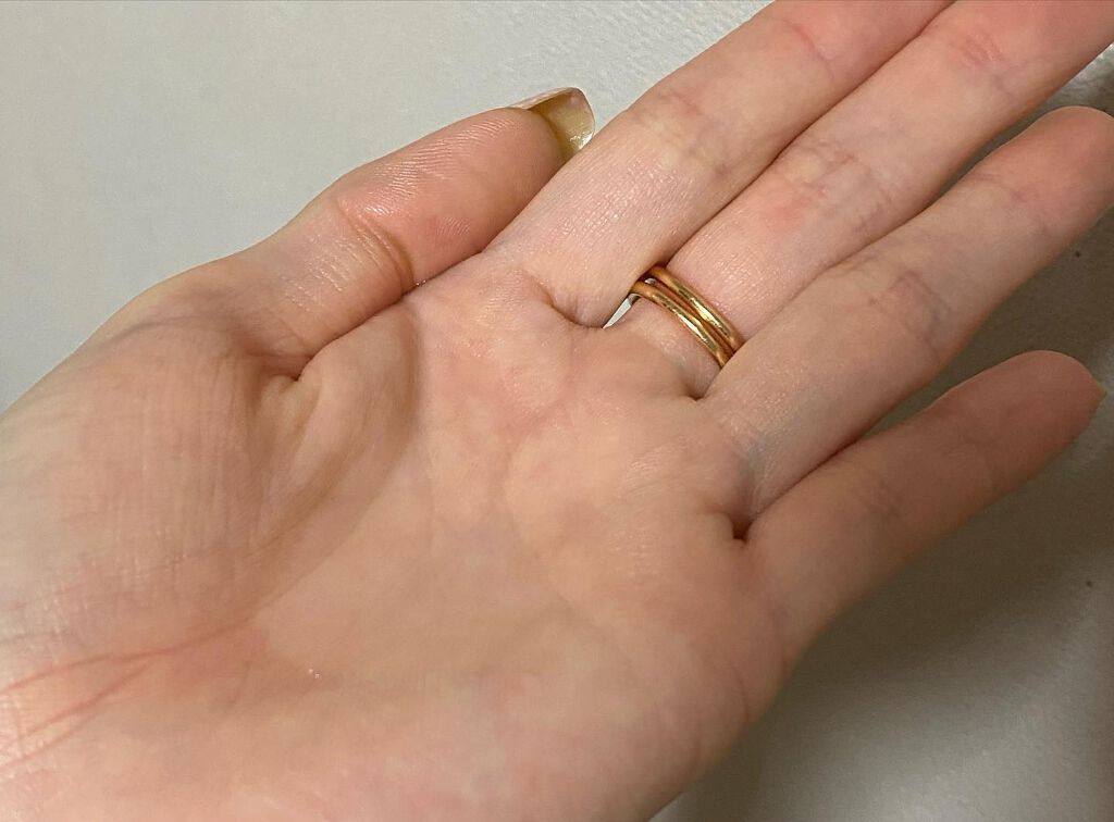 薬用アクレケア/総健美舎/美容液を使ったクチコミ（3枚目）