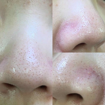 ハトムギ化粧水(ナチュリエ スキンコンディショナー R )/ナチュリエ/化粧水を使ったクチコミ(4枚目)