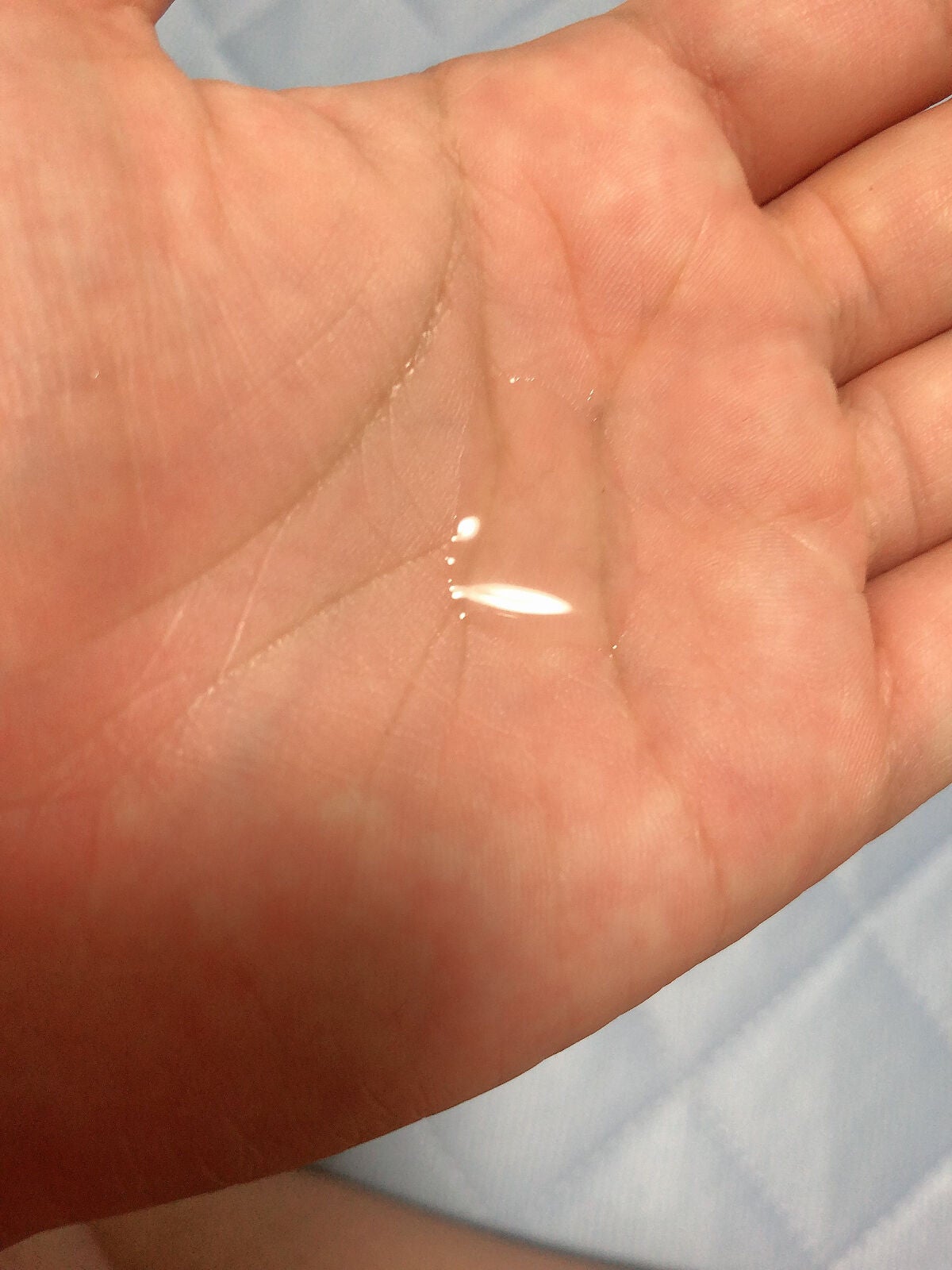 ダーマレーザー スーパーVC100ローション(さっぱり)/クオリティファースト/化粧水を使ったクチコミ(2枚目)