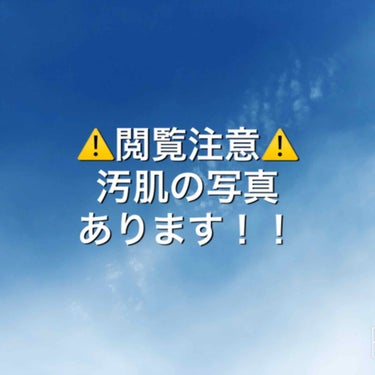 フレッシュ クリア サクラ クレンジング オイル/shu uemura/オイルクレンジングを使ったクチコミ（1枚目）