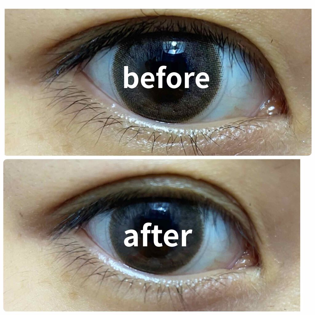 ふたえテープ 目立たず肌になじむ絆創膏タイプ/DAISO/二重まぶた用アイテムを使ったクチコミ(1枚目)