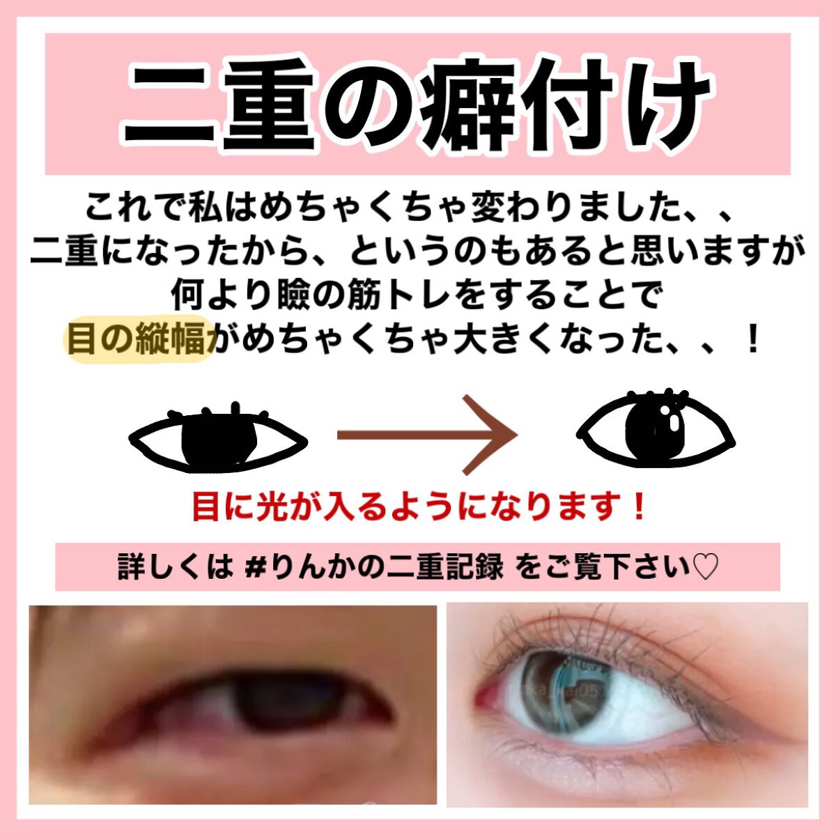 カールプロ SR/クレイツ/カールアイロンを使ったクチコミ（3枚目）