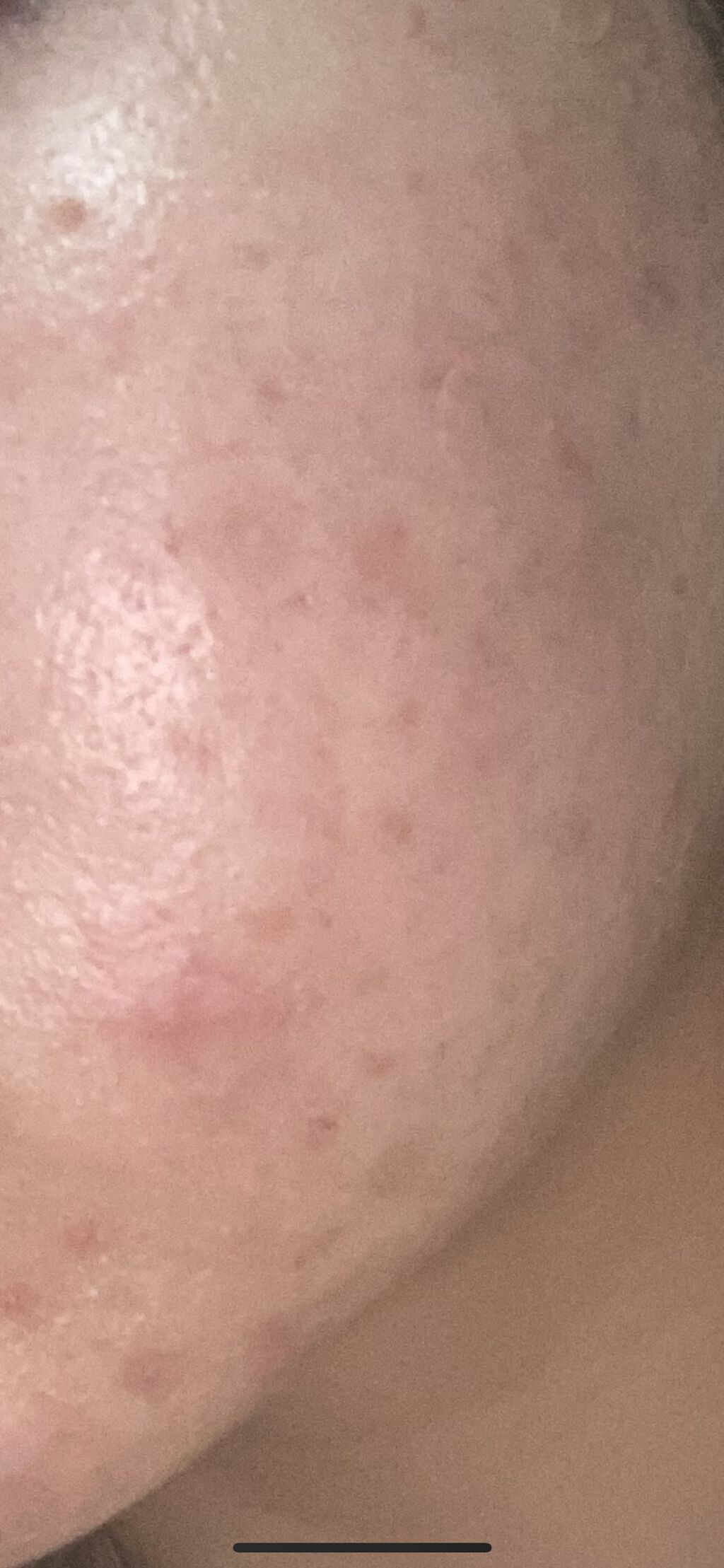 アミノ酸浸透ジェル/Mマークシリーズ/フェイスクリームを使ったクチコミ（2枚目）