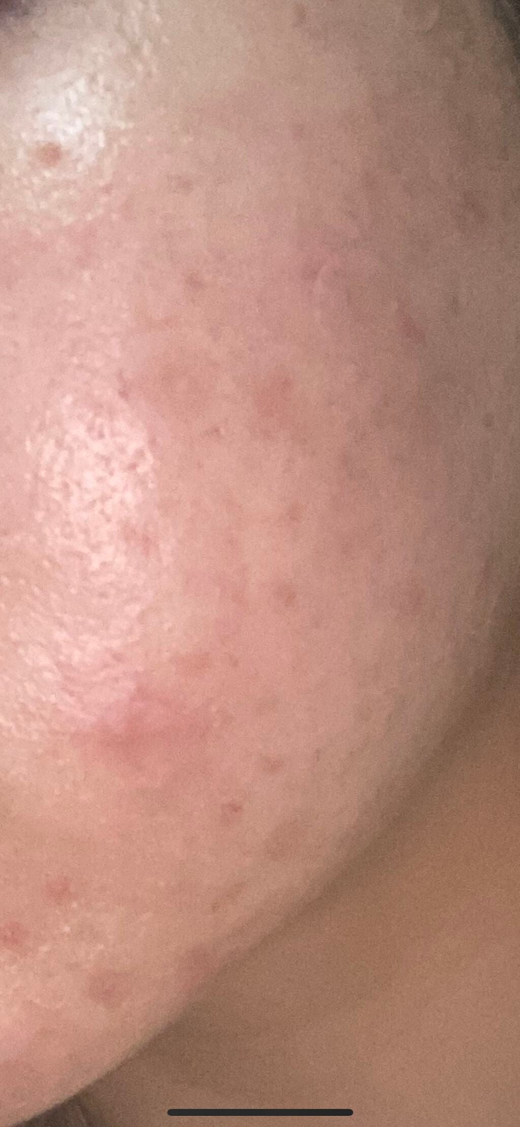 クリーム/キュレル/ボディクリームを使ったクチコミ(2枚目)