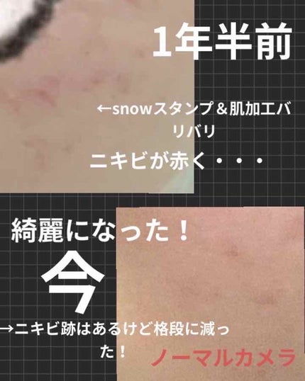 ホワイトニングクリア ローション/d プログラム/化粧水を使ったクチコミ(2枚目)