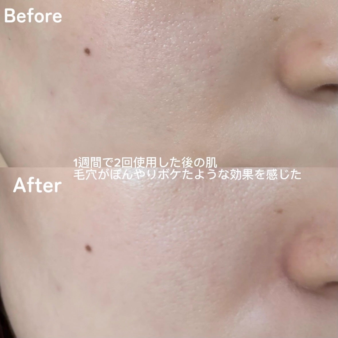 ダイヤスピキュール/NUDIQUE/美容液を使ったクチコミ(3枚目)