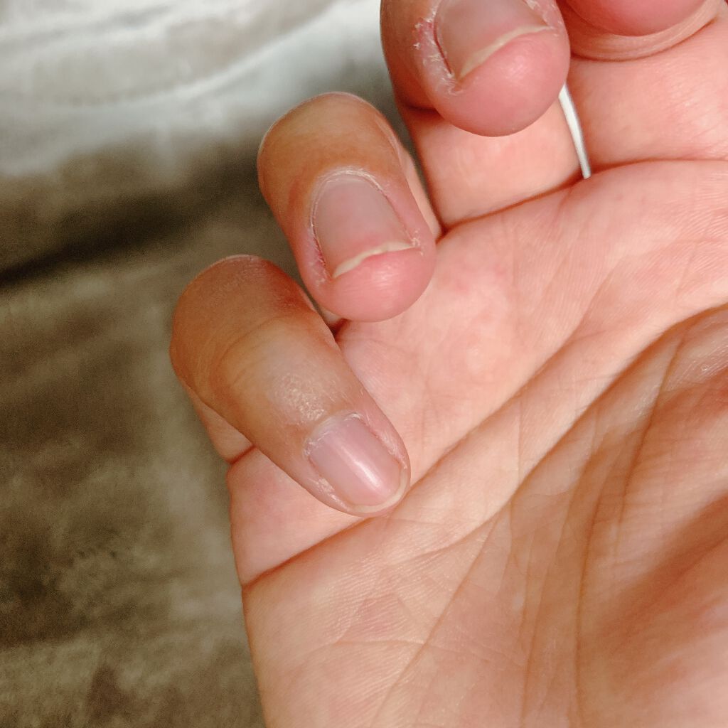 オイルインキューティクルプッシャーペン/ビューティーワールド/ネイル用品を使ったクチコミ(2枚目)