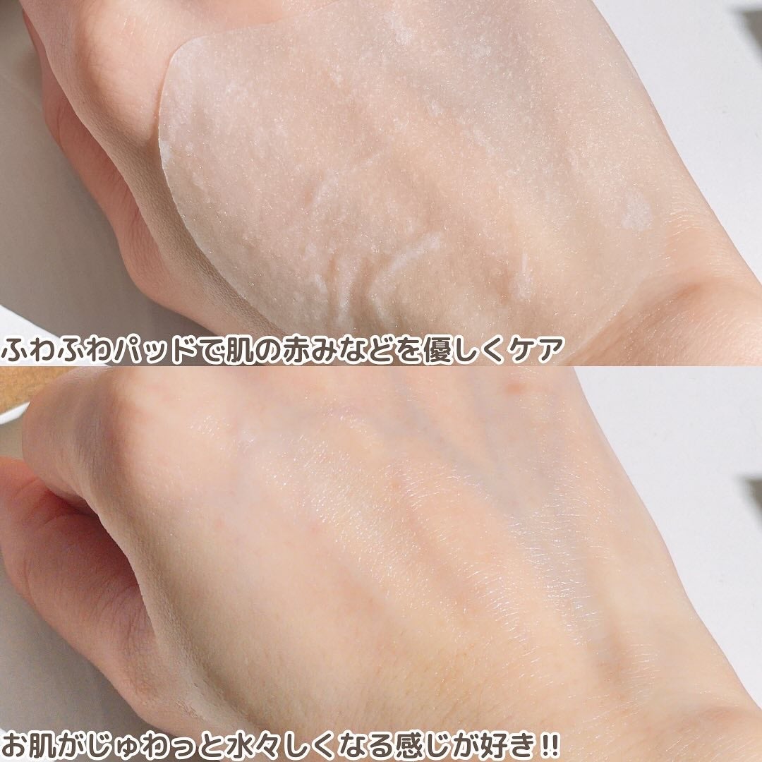 センテラ クイックカーミングパッド/SKIN1004/トナーパッドを使ったクチコミ(4枚目)