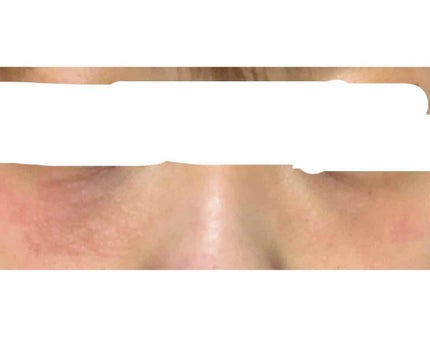 ノンクマ/ビー・エヌ/シートマスク・パックを使ったクチコミ(1枚目)