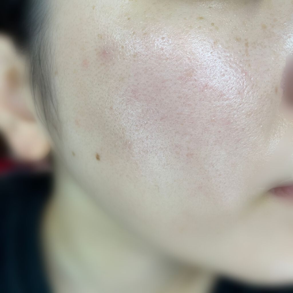 UVイデア XL プロテクショントーンアップ/ラ ロッシュ ポゼ/日焼け止めクリームを使ったクチコミ（3枚目）