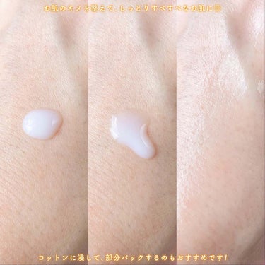 CERAPYome Moist In Treatment/my skin solus/美容液を使ったクチコミ（7枚目）