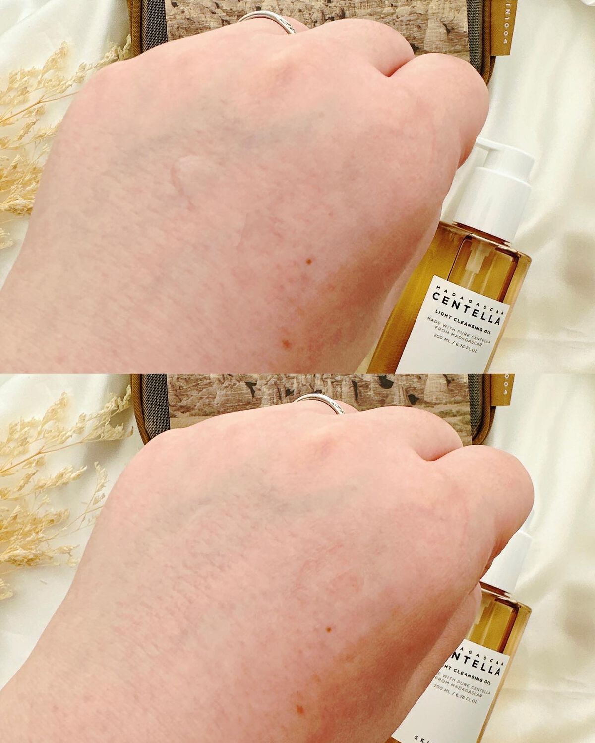 センテラ アンプル/SKIN1004/美容液を使ったクチコミ(4枚目)