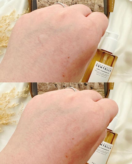 センテラ アンプル/SKIN1004/美容液を使ったクチコミ(4枚目)